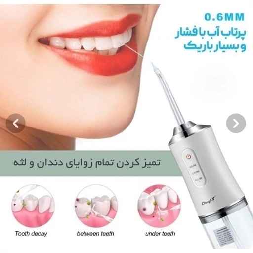 واترجت شست و شوی دهان و دندان
